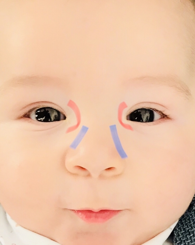 Масажа ока за очи код беба