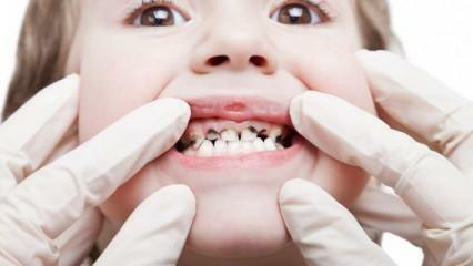 Завршите стоматолошку негу вашег детета током семестра!