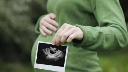 Када је пол бебе најранији и дефинитивнији? Ко одређује пол?