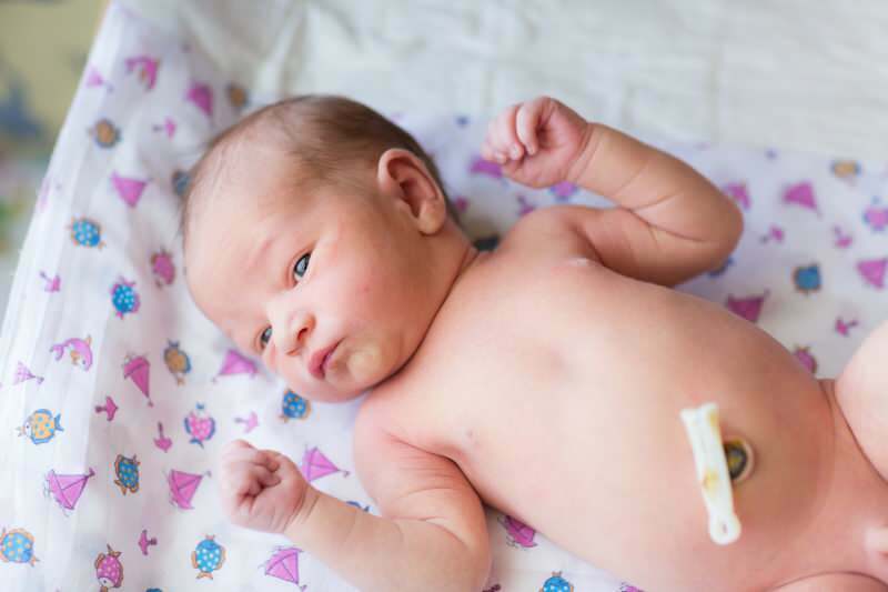 Касно сечење пупчане врпце код беба