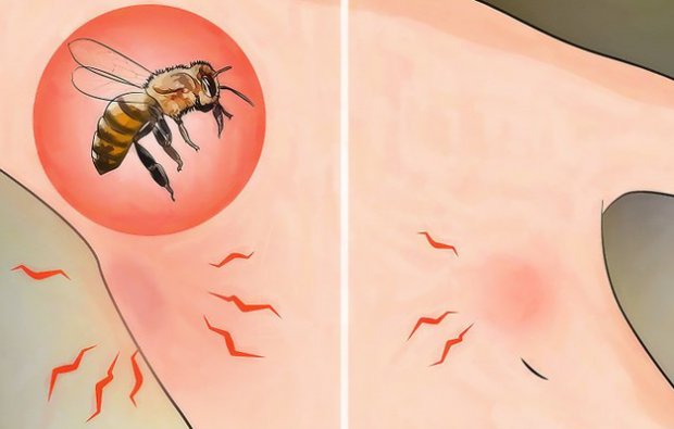 Шта је алергија на пчеле и који су симптоми? Природне методе које су добре за пчелиње убоде