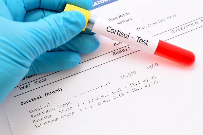 ниво кортизола јавља се у крвним тестовима