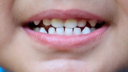 Како научити децу стоматолошкој нези?