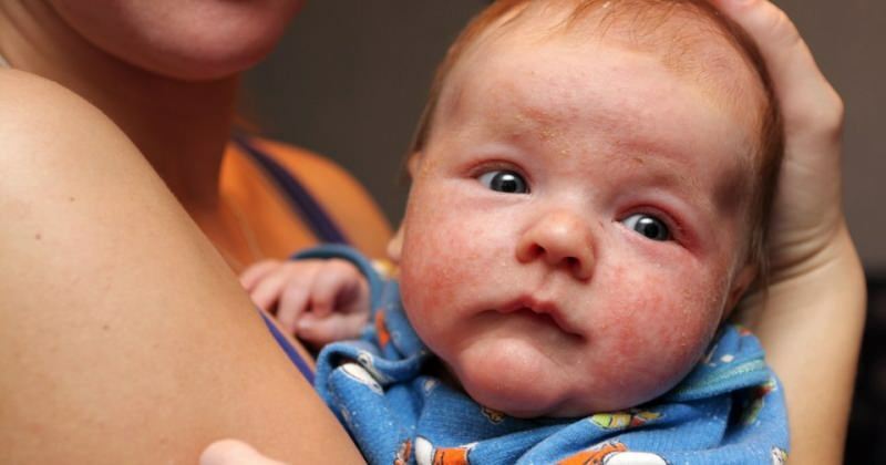 Узроци црвенила очију код новорођенчади