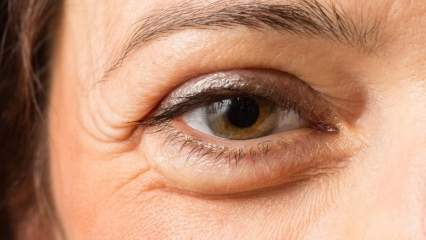 Како пролазе вреће испод очију? 10 најбољих крема за торбе испод ока