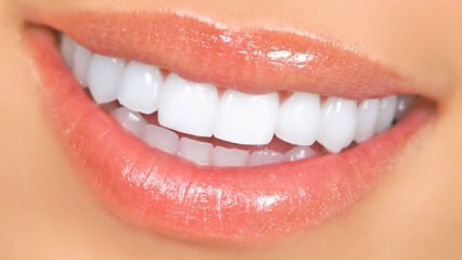 Природне методе избјељивања зуба