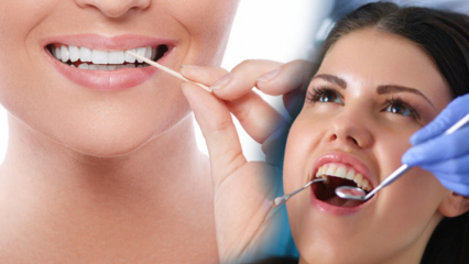 Како одржавати орално здравље и здравље зуба? Шта треба узети у обзир приликом чишћења зуба?