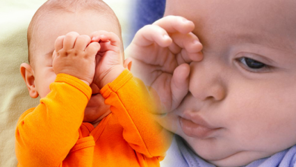 Природна решења за опеклине очију код беба