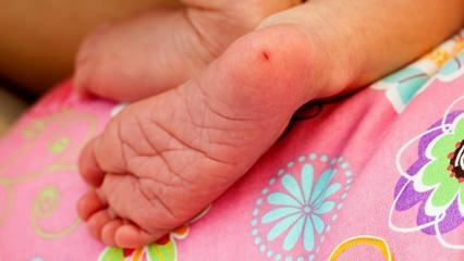 Зашто се узима крв из пете код новорођенчади? Захтеви за тестирање пете крви код одојчади