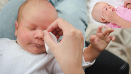 Како уклонити ране код беба? Узрокује пуцање ока код беба? Бурр масажа мајчиним млеком