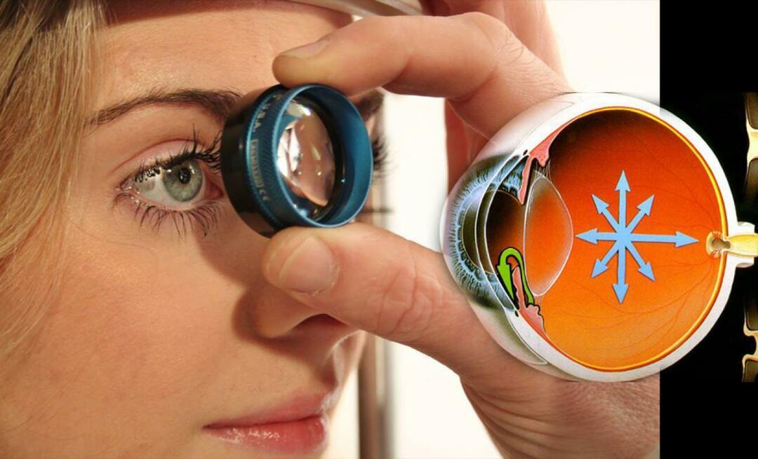 Шта је глауком? Обратите пажњу на ову болест која подмукло напредује без икаквих симптома!