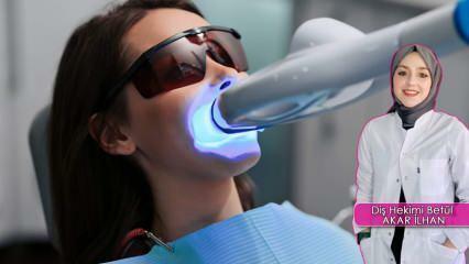 Како се ради метода избељивања зуба? Да ли метода бељења оштећује зубе?