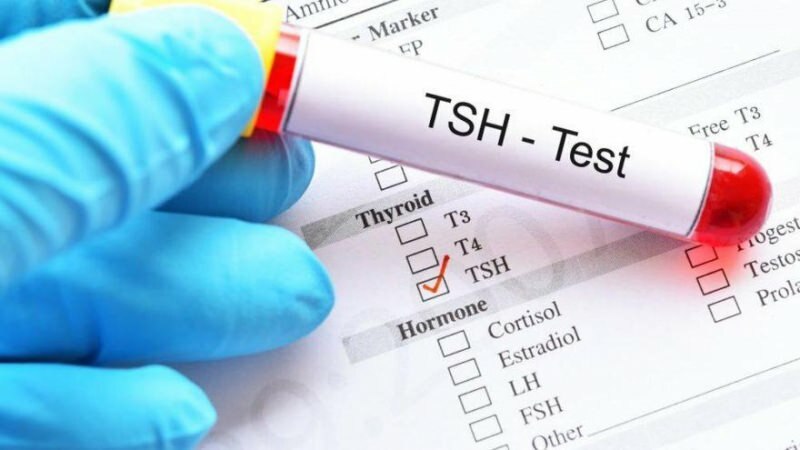 Шта је ТСХ тест? Који су симптоми ТСХ? Шта значи ТСХ висок и низак?