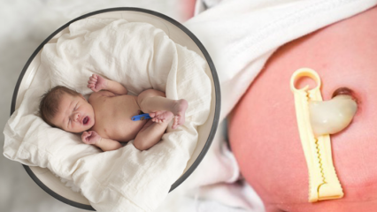 Шта је Плацента Превиа? Како да се брине за пупчану врпцу код беба? Ако је пупчана врпца дугачка ...