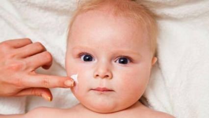 Савети за негу коже беба! Који су проблеми са кожом код беба?