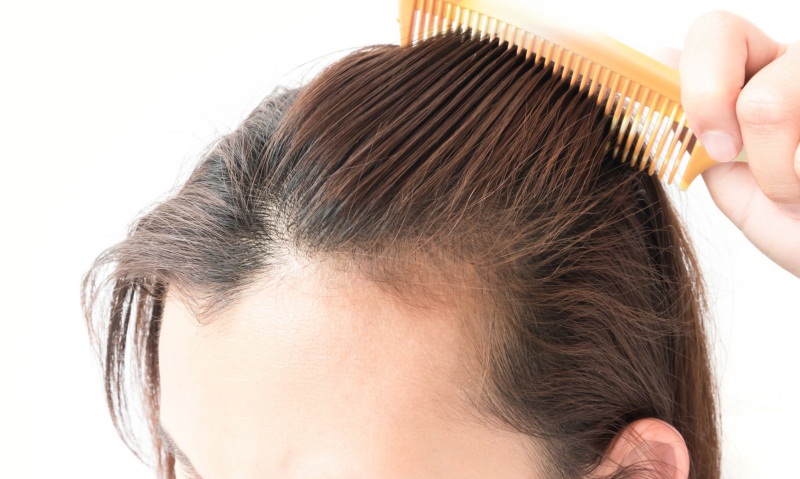 рјешења против губитка косе након порођаја! Шта је добро за губитак косе?