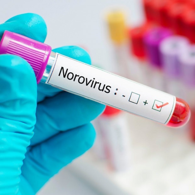 Шта је норовирус и које болести изазивају