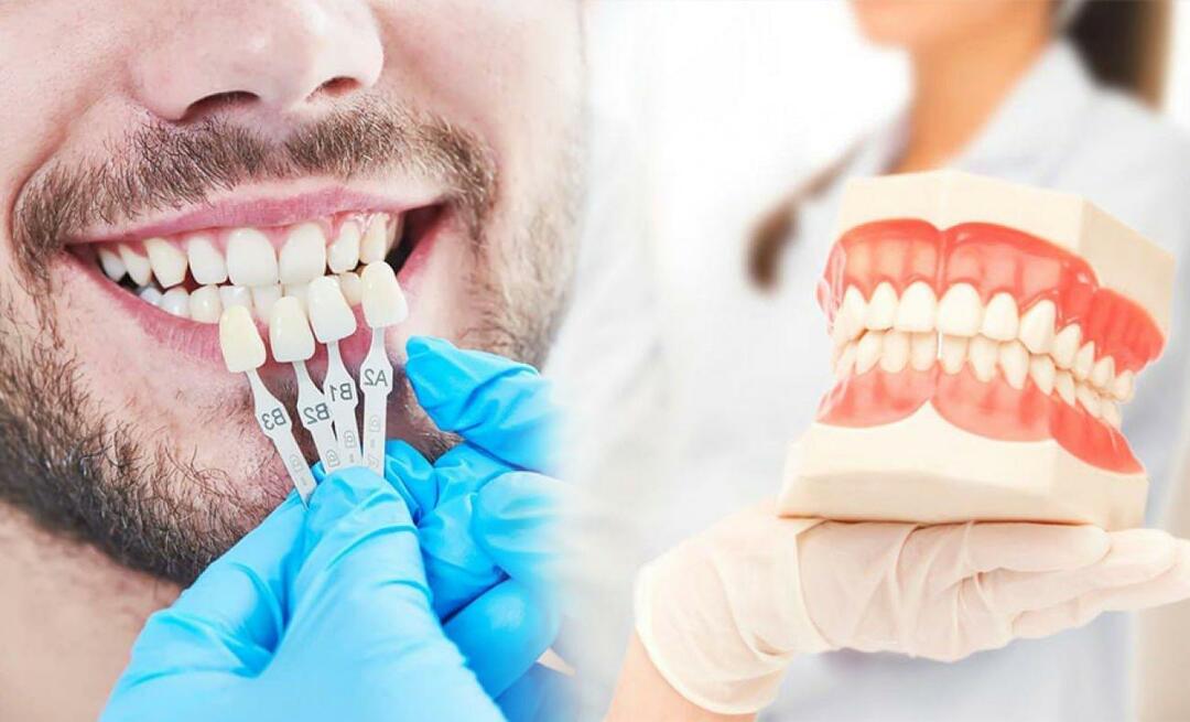 Зашто се цирконијумске крунице постављају на зубе? Колико је издржљив цирконијумски премаз?