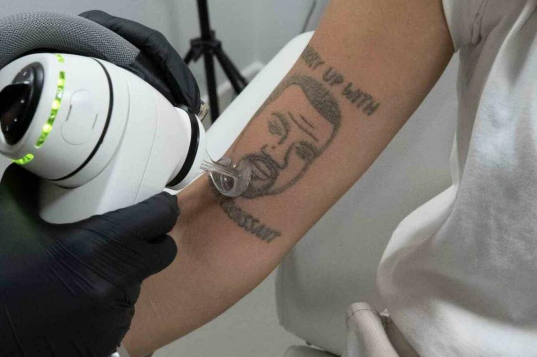 Тетоважа Кањеа Веста биће уклоњена бесплатно у Лондону 