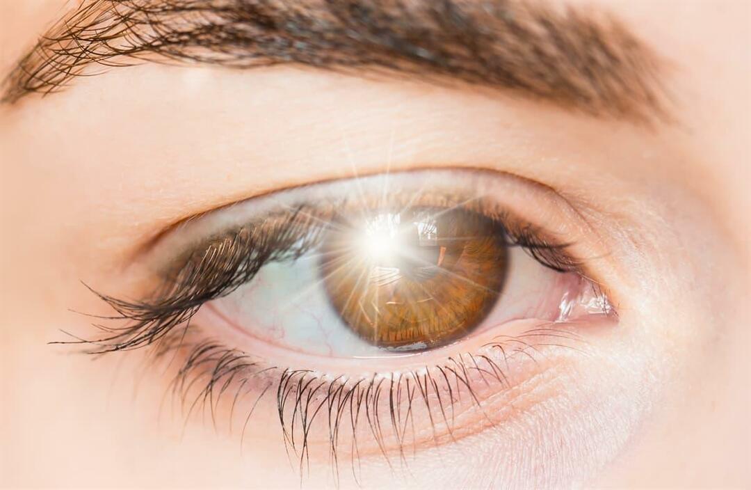 Шта узрокује бљесак светлости у оку и како се лечи?