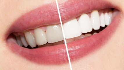 Које су препоруке за беле зубе? Избељивање зуба природно лечи код куће ...
