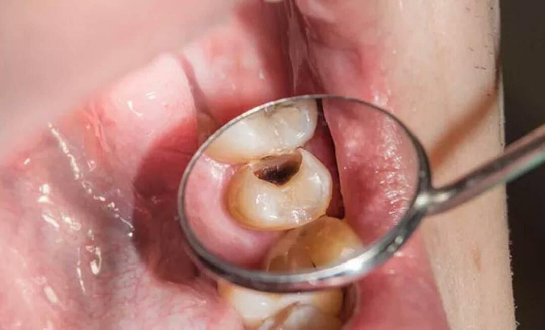 Зашто зуби труну и шта можемо да урадимо да то спречимо? 
