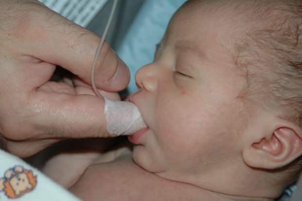 Шта је метода храњења прстима? Како нахранити бебу шприцом?