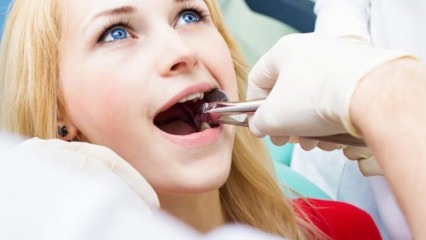 Да ли је вађење зуба током трудноће?