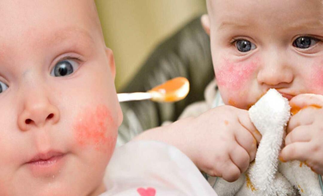 Шта треба да једе беба са алергијама? Која је алтернативна храна за алергичну бебу?